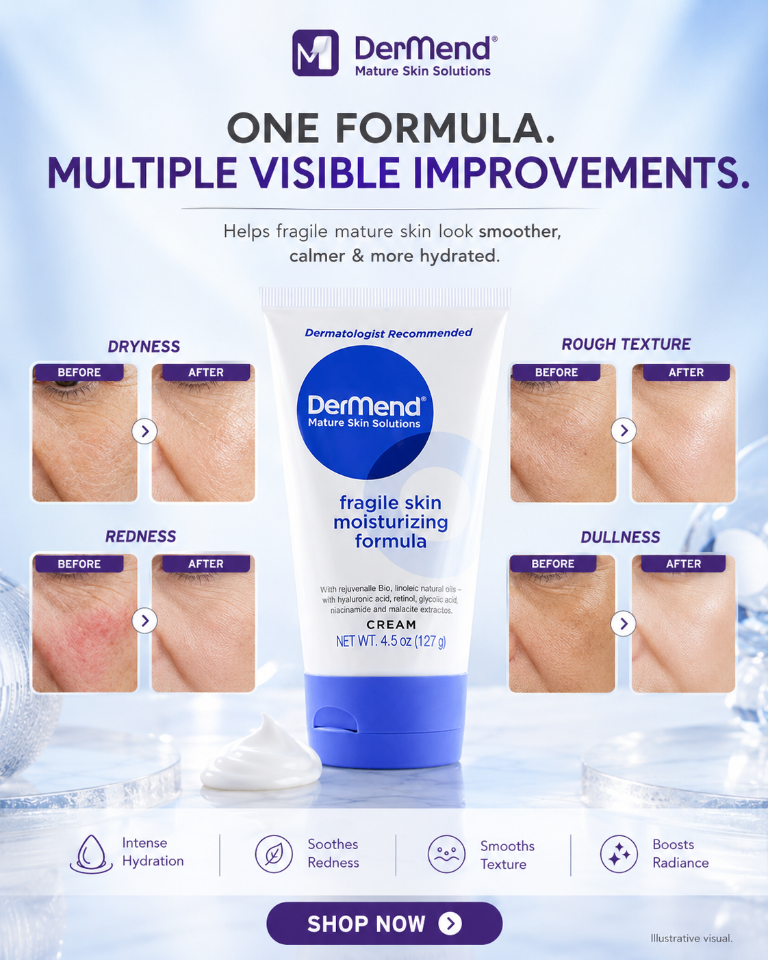 DerMend Fragile Skin Moisturizing Formula Cream