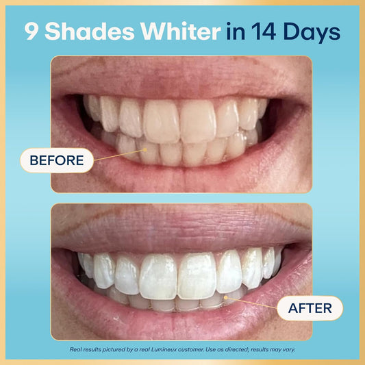 Lumineux Teeth Whitening Strips