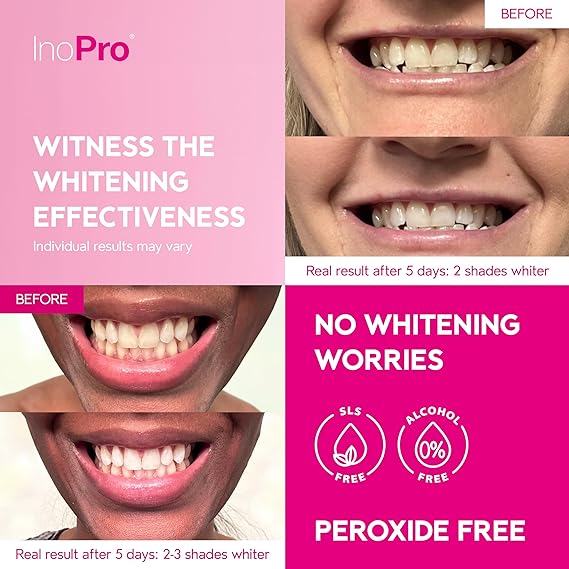 InoPro Green Teeth Whitening Strips