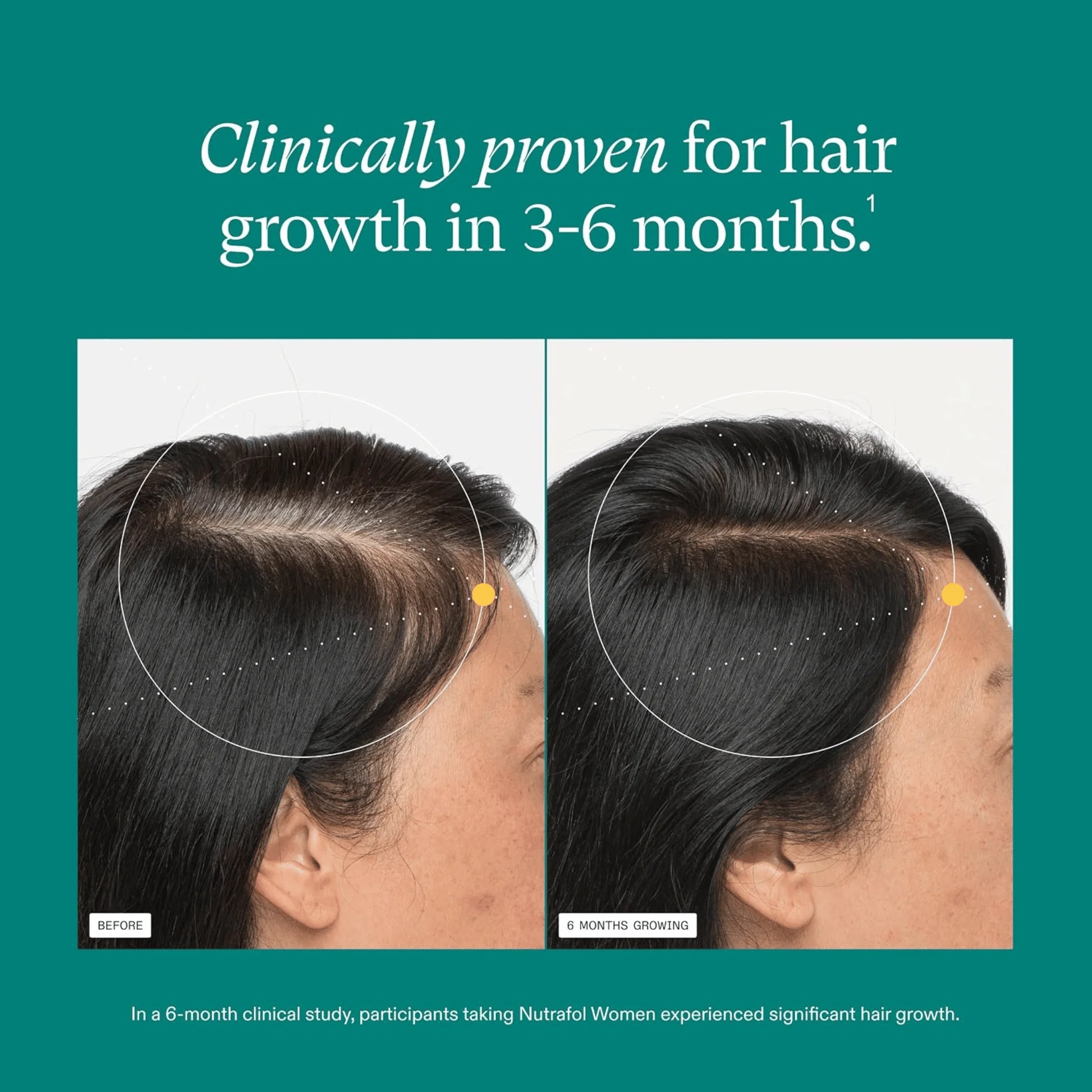 Before and after comparison of hair growth with text about clinical testing on a green background.