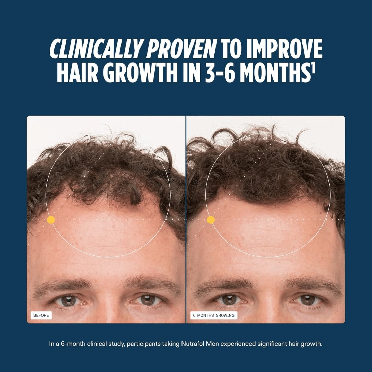 Nutrafol Men Hair Growth Supplements, Ages 18-49