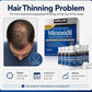Kirkland Minoxidil hair regrowth treatment packaging for men with a man looking at his receding hairline.