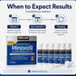 Kirkland Minoxidil product packaging with usage instructions on a white background