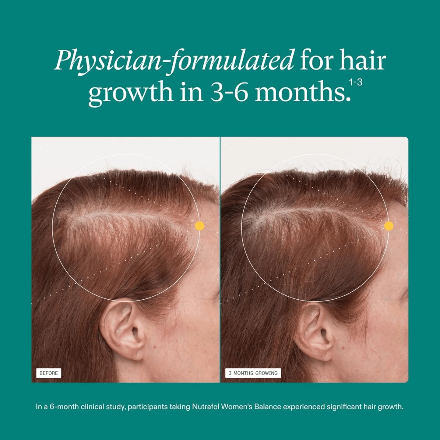 Before and after comparison of hair growth with text about physician-formulated product for hair growth.
