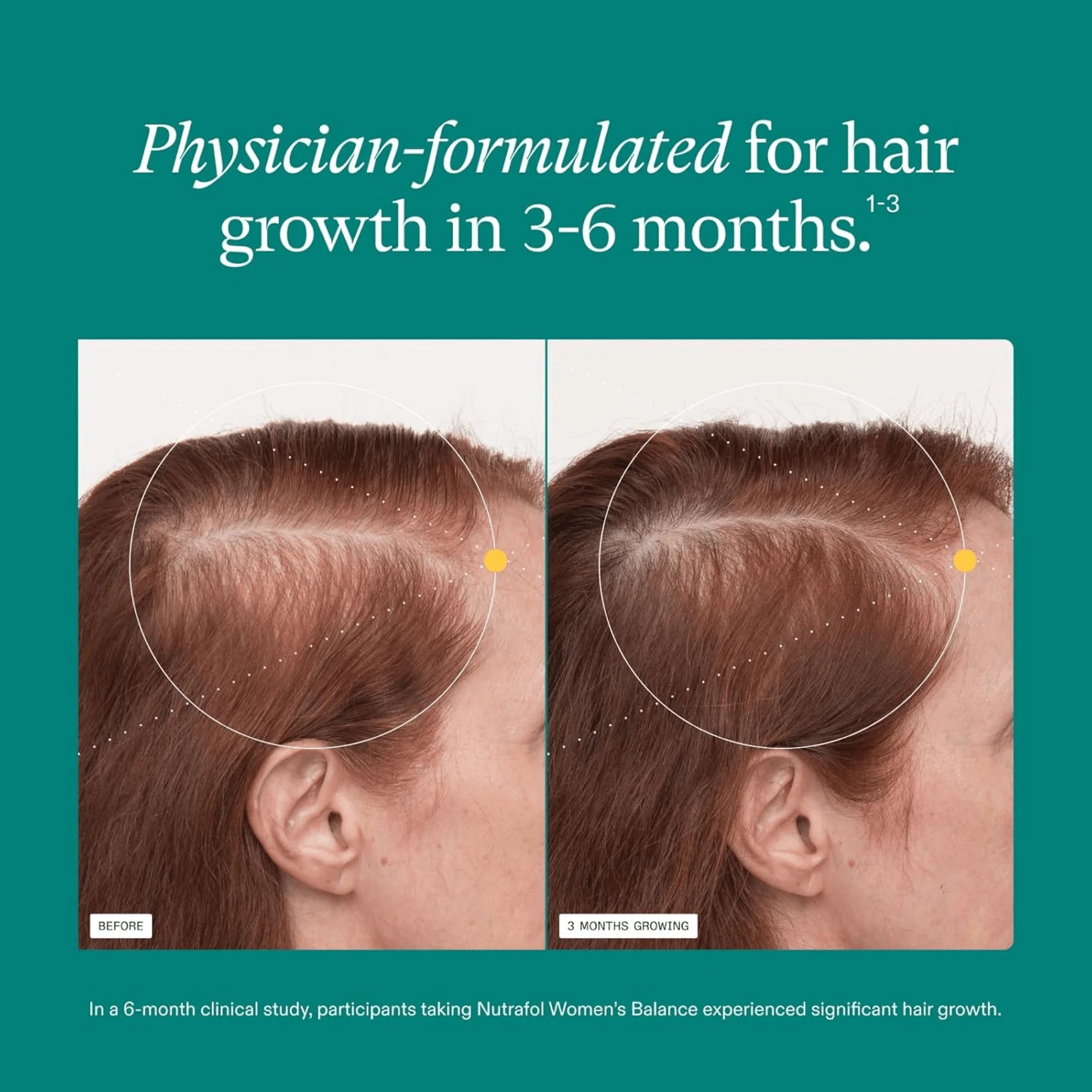 Before and after comparison of hair growth with text about physician-formulated product for hair growth.